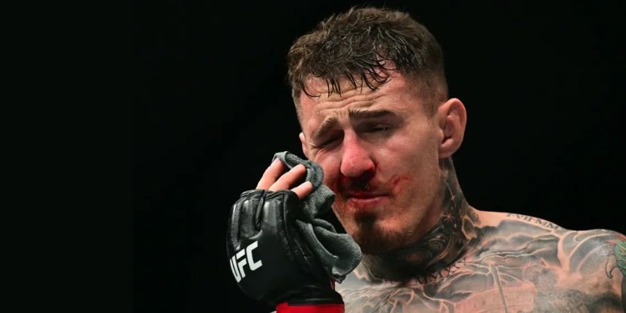 You are currently viewing Tom Aspinall Reveals Medical Report Confirming Serious Eye Injury After Ciryl Gane Eye-Poke